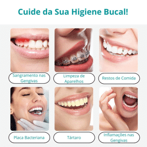 Limpador Bucal Portátil Irrigador Oral Bivolt Usb