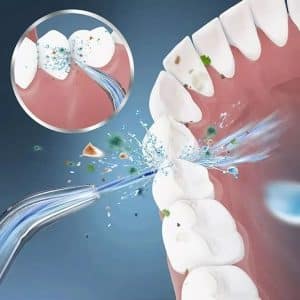Limpador Bucal Portátil Irrigador Oral Bivolt Usb
